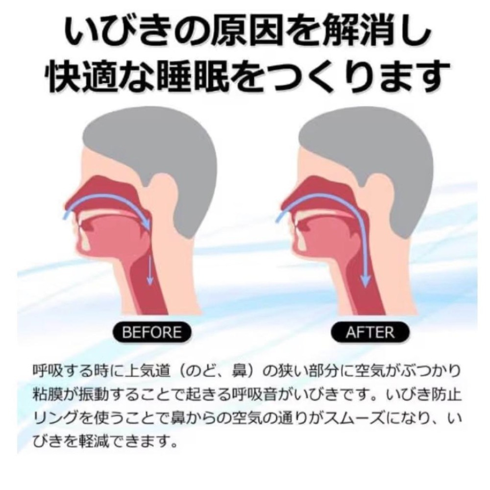 止鼾戒指 止鼾戒指 快速睡眠環 日本當地購入 含四色 免指定 防打呼戒指-細節圖4
