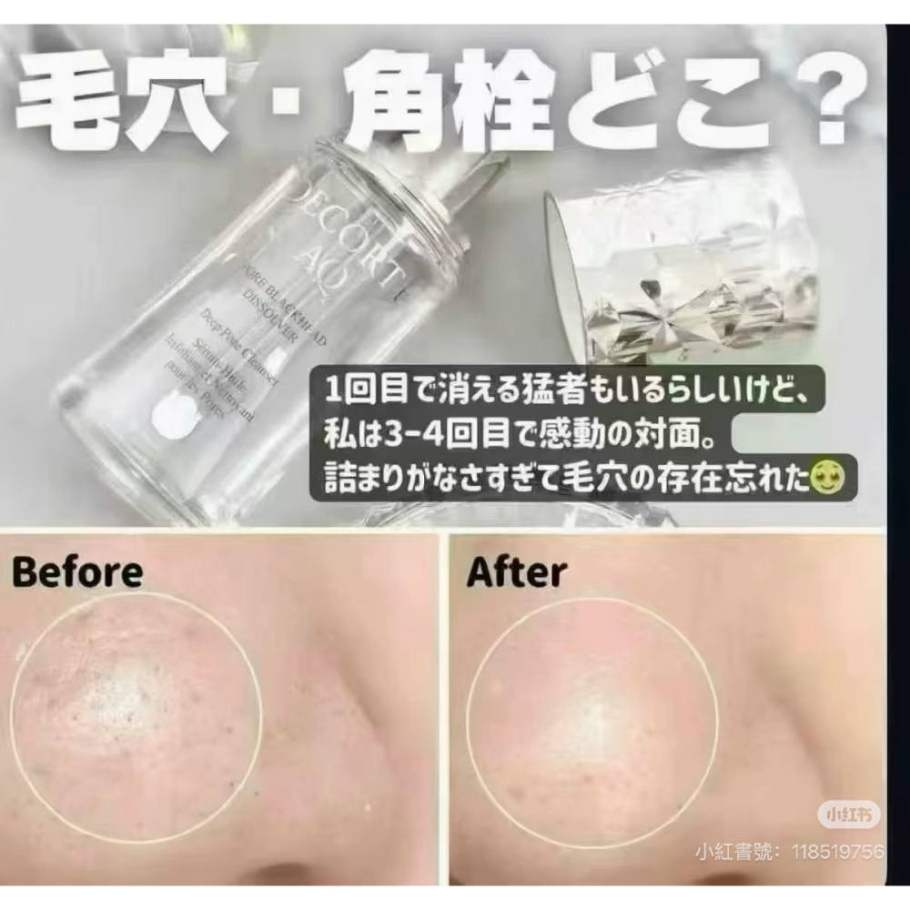 保證正貨⭐️DECORTÉ AQ 黛珂 溶解黑頭毛孔護理油 6ml-細節圖2
