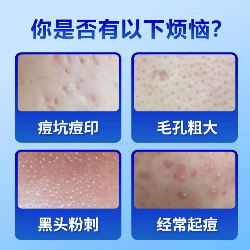 日本直送⭐️日本資生堂 IHADA成人痘痘治療軟膏26g 除痘藥膏  日本藥妝必買-細節圖2