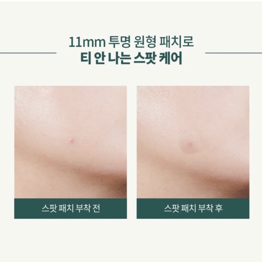 ✈️韓國代購 Skinae 茶樹痘痘貼 （90入）-細節圖4