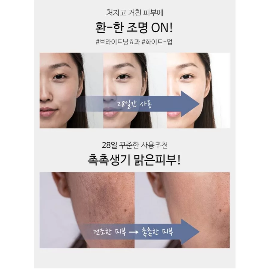 ✈韓國代購 高麗雅娜 SSO 28天美白斑點安瓶精華-細節圖6