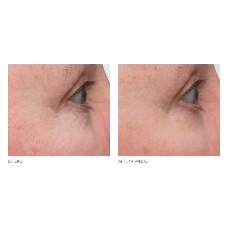 美國代購現貨Kate Somerville Retinol A醇視黃醇 緊緻眼霜眼部保養-細節圖3