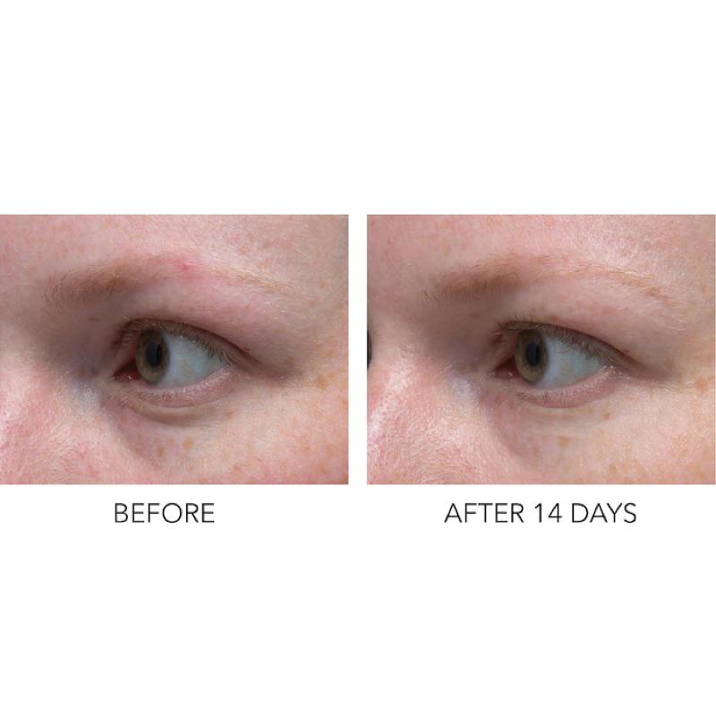 DR. DENNIS GROSS Hyaluronic Marine Dew It All眼霜玻尿酸極限保濕眼膠海洋膠原-細節圖3