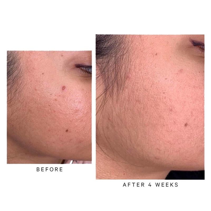 現貨 英國MZ SKIN Retinol 2%視黃醇煥膚精華油面油RETINOL 2% A醇維生素維他命-細節圖2