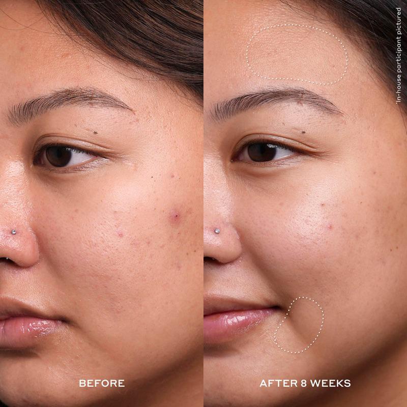 英國代購現貨Olehenriksen 20%Acid Night Treatment夜間晚間果酸精華美白提亮-細節圖2