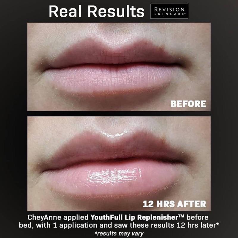 美國代購現貨Revision skincare YouthFull Lip Replenisher抗老化護唇膏保濕潤唇膏-細節圖4