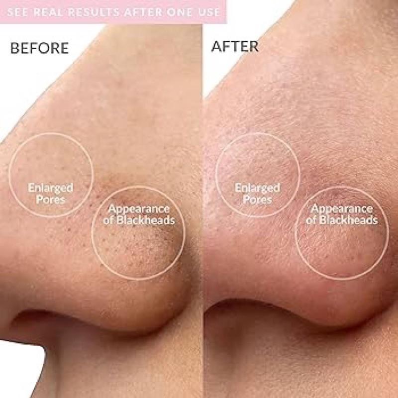 Pmd wave pro 潔面儀毛孔去角質黑頭清潔器家庭水療儀-細節圖5