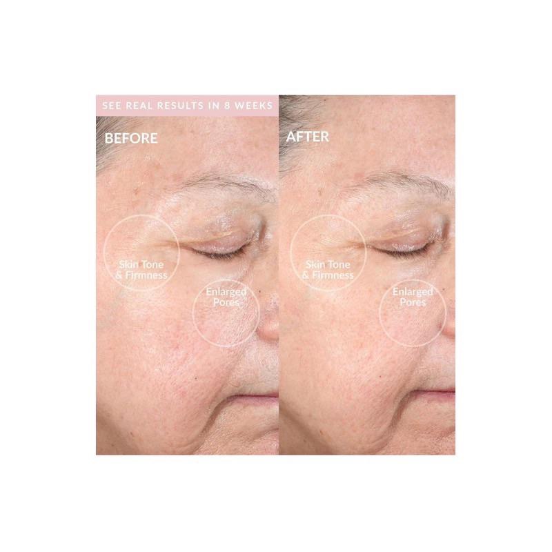 明星同款愛用好物🔥美國PMD pro RQ潔面儀至臻玉石去黑頭洗臉神器按摩聲波清潔敏感肌洗臉儀 潔顏超導晶石美容儀-細節圖4