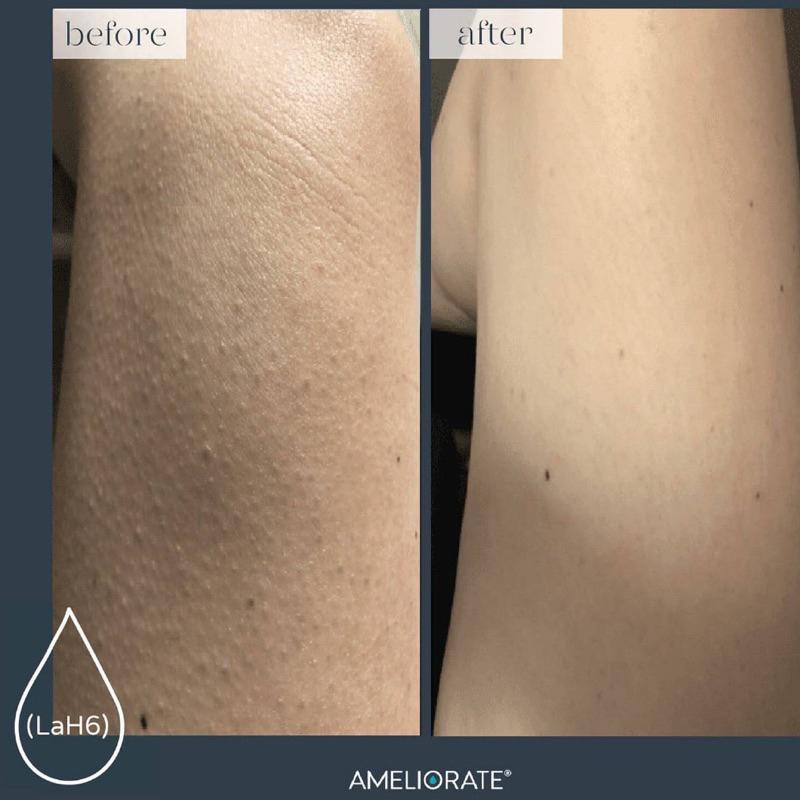 英國代購現貨🔥AMELIORATE身體乳液200ml 毛孔角化保濕滋潤潤澤沐浴露 沐浴乳 去角質霜-細節圖4