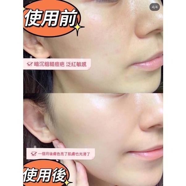 mini♥️咪妮♥️韓國 Ladykin JOAJOTA 新版 童顏小燈泡精華 精華液 逆齡 rain代言 10包-細節圖2