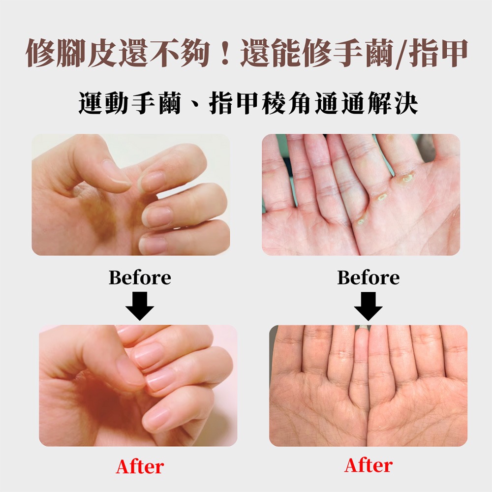 急速出貨Fullidea FootShine 集塵美足機 電動磨腳皮機 角質 腳皮 去死皮 去老繭 足部美容-細節圖5