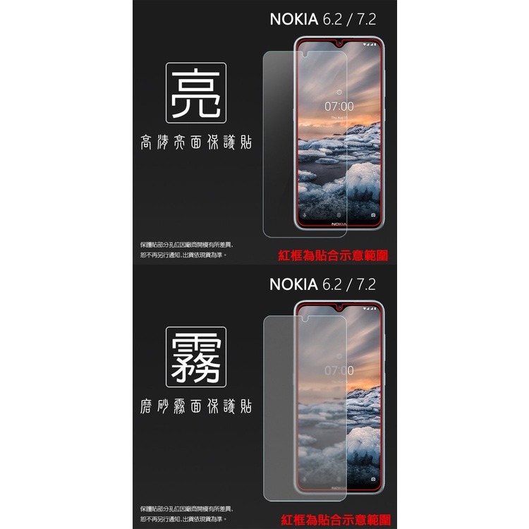 亮面 霧面 螢幕保護貼NOKIA 6 2018 6.1 7 Plus 7.2 2.1 X71 X30 軟性 亮貼 霧貼-細節圖6