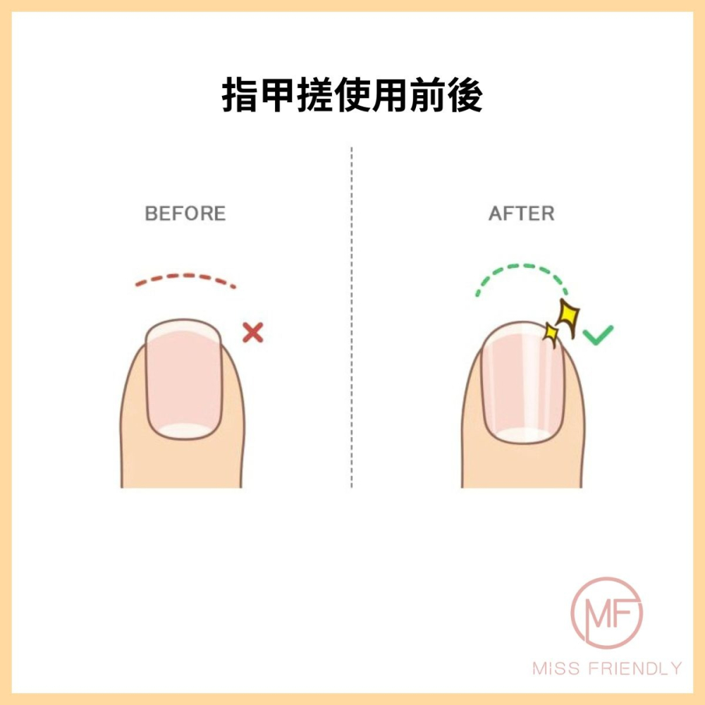 現貨 台灣 ✨ 奈米玻璃磨腳皮器 納米玻璃去腳皮器 去死皮搓腳板 磨砂除腳皮 磨腳皮神器 去腳皮神器 去角質磨砂板-細節圖7