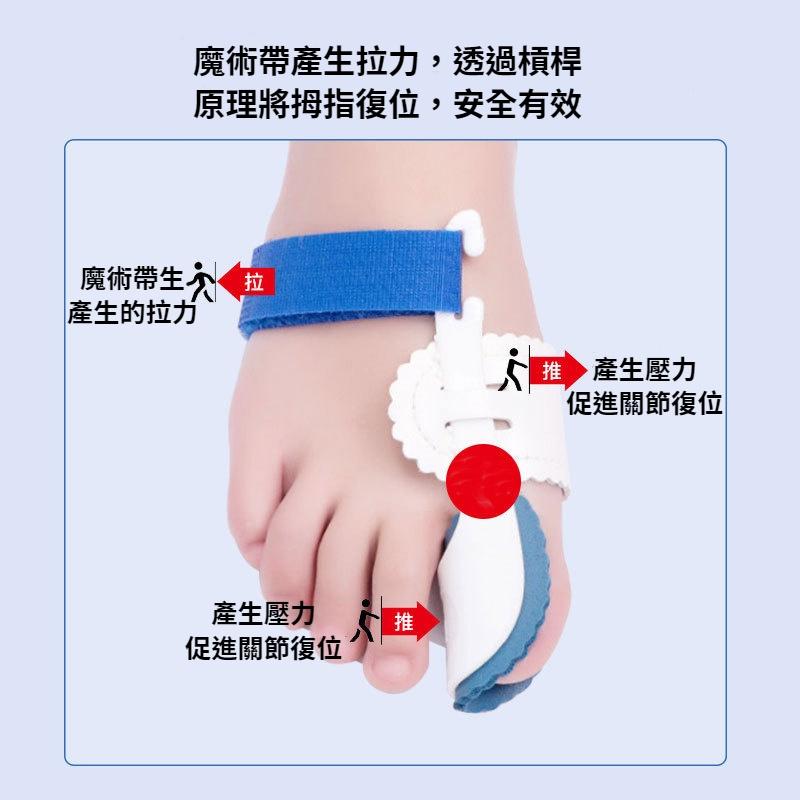 台灣現貨當天寄出 拇指外翻矯正器 夜用型 大拇指分離器 腳趾矯正器 腳趾分離器 拇指外翻-細節圖4