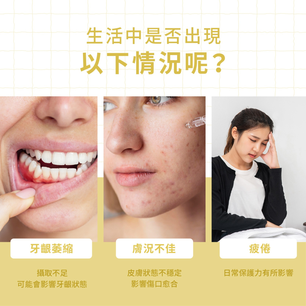 優維特 VITA 維他命C 1000mg 無二氧化矽 無色素 素食可用 高劑量 挑戰全台最少化學賦形劑-細節圖3