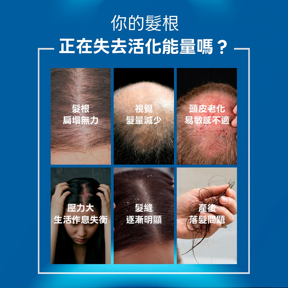 【LA EXO】萊泌兒 999外泌體養髮液 30ml-細節圖3