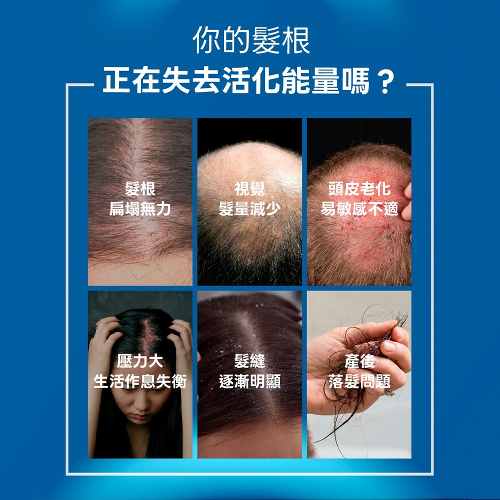 【LA EXO】萊泌兒 999外泌體養髮液 30ml-細節圖3