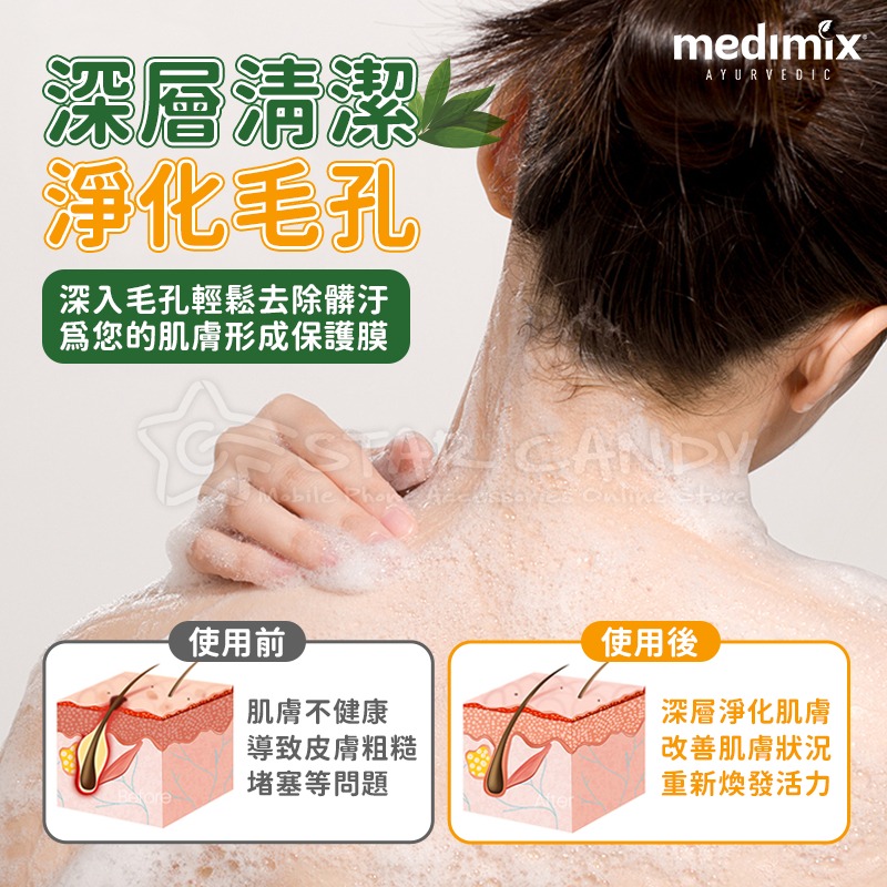 MEDIMIX 印度綠寶石皇室藥草浴 美肌皂 藥草浴皂 印度肥皂 肥皂 香皂 沐浴乳 沐浴 【A207】-細節圖3