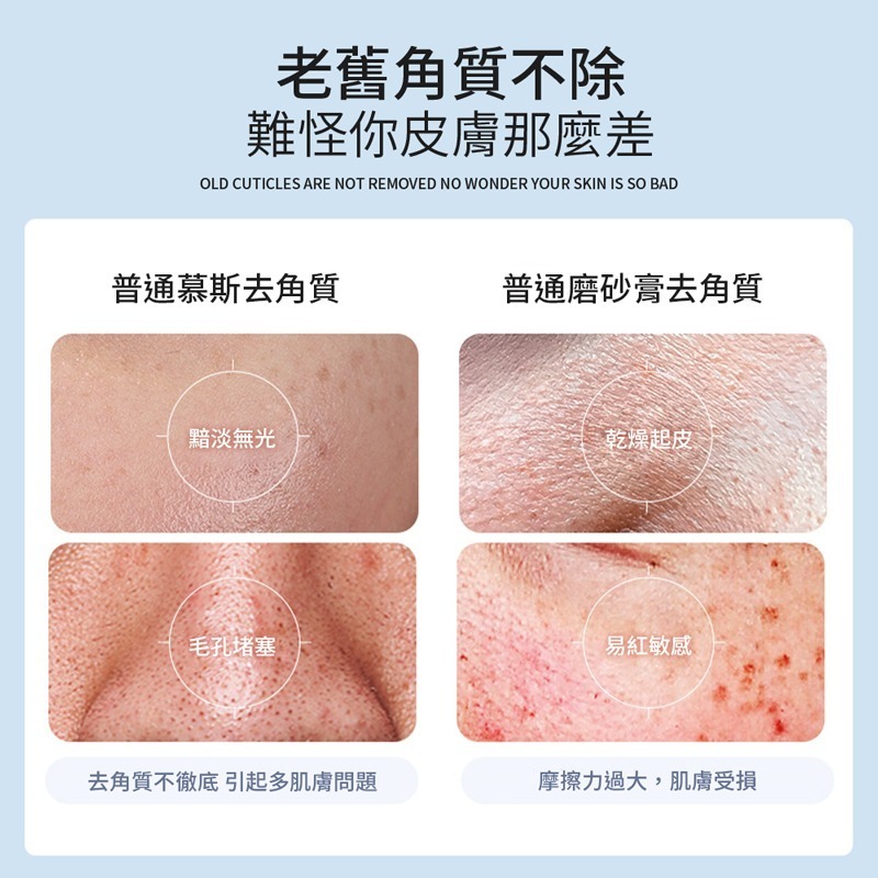 檸檬去角質 250G 去角質素 檸檬去角質素 果凍質地 臉部去角質 清潔毛孔 溫和清潔 去角質潔面膠【MZ0383】-細節圖3