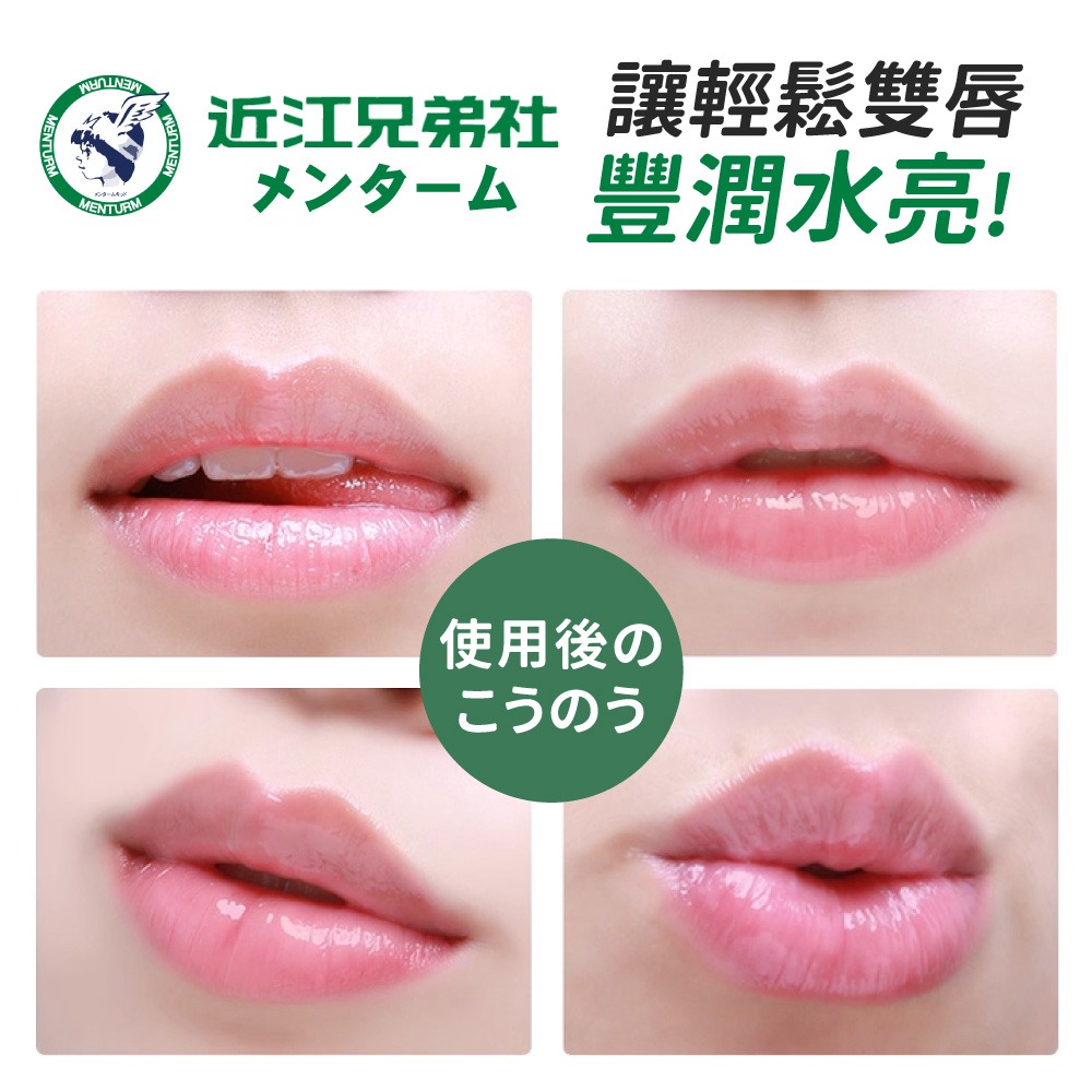 OMI 近江兄弟 護唇膏 日本原裝 潤唇膏 保濕唇膏 唇膏 熱銷經典款 口紅打底 嘴唇保養【MZ0458】-細節圖7