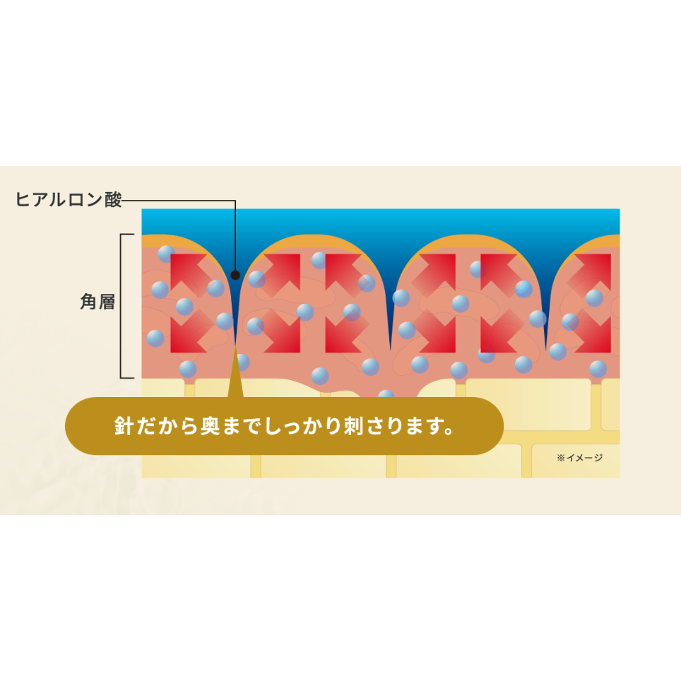 【沐樽🇯🇵日本】KOSE高絲 clear turn 境內版 睡眠型 玻尿酸微針局部面膜 3回(6枚)-細節圖3