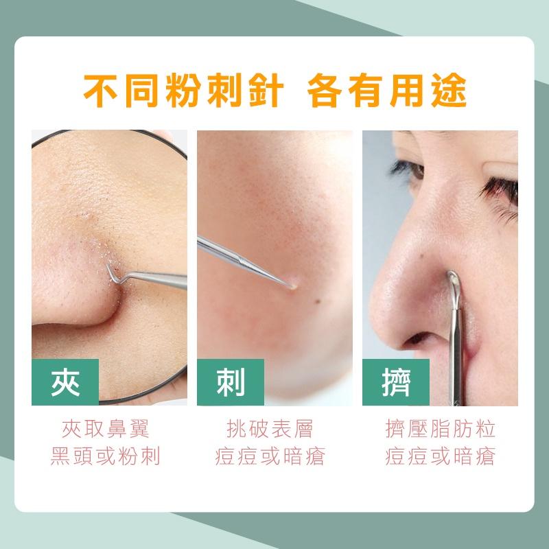 【台灣現貨 免運費！贈收納盒】不鏽鋼粉刺夾 挑痘針 黑頭粉刺 清粉刺 痘痘棒 去粉刺 粉刺棒 美容針 粉刺針 拔粉刺-細節圖3
