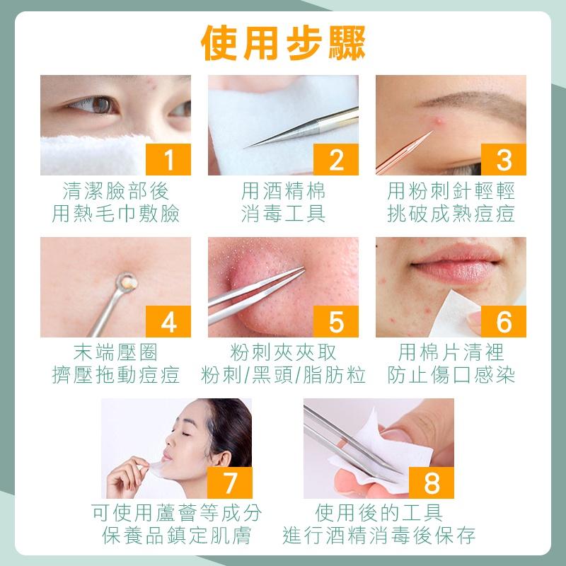 【台灣現貨 免運費！贈收納盒】不鏽鋼粉刺夾 挑痘針 黑頭粉刺 清粉刺 痘痘棒 去粉刺 粉刺棒 美容針 粉刺針 拔粉刺-細節圖4