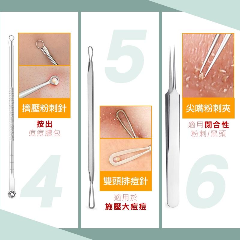 【台灣現貨 免運費！贈收納盒】不鏽鋼粉刺夾 挑痘針 黑頭粉刺 清粉刺 痘痘棒 去粉刺 粉刺棒 美容針 粉刺針 拔粉刺-細節圖6
