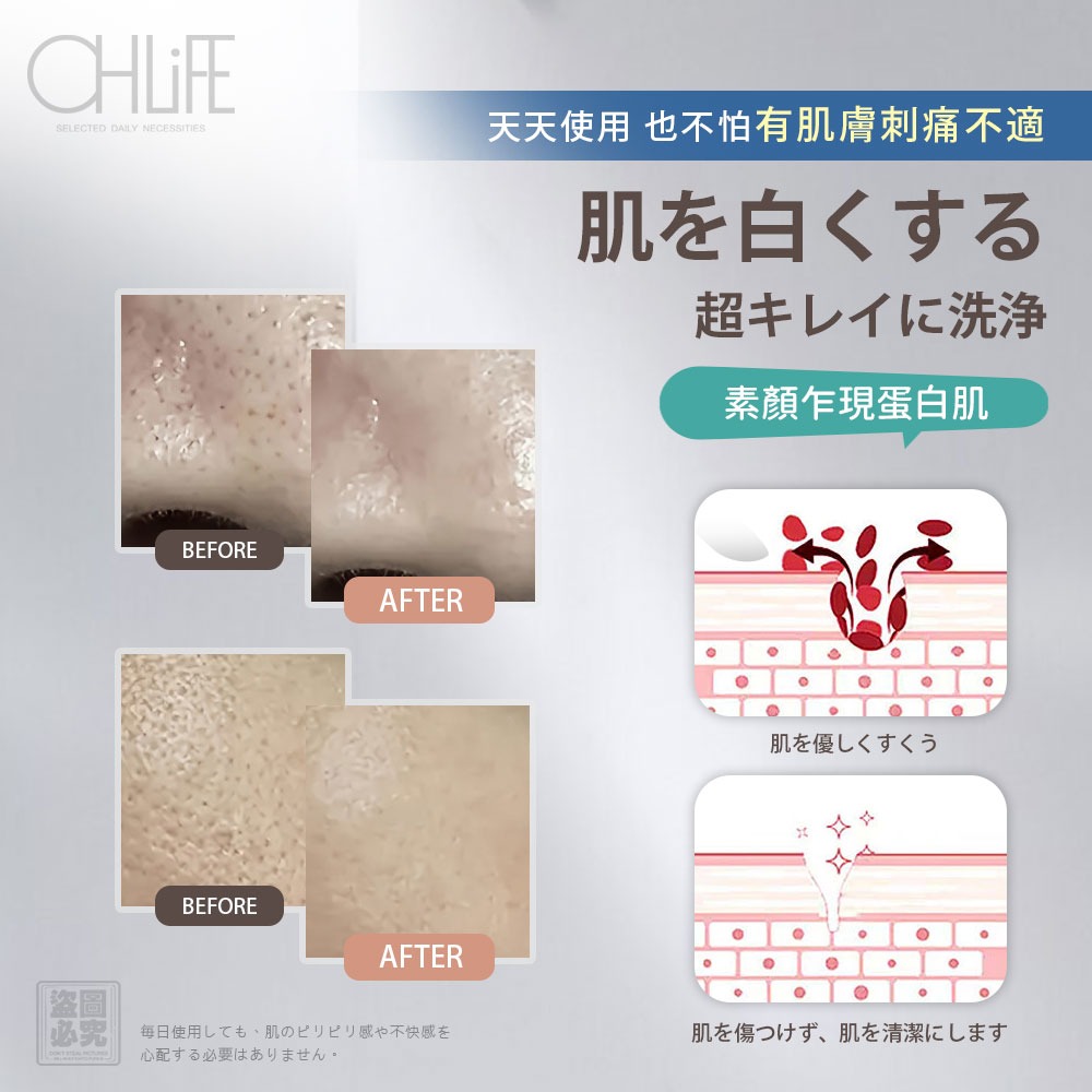 OHLIFE 黑頭必殺 潔膚除粉刺兩用鏟-細節圖5