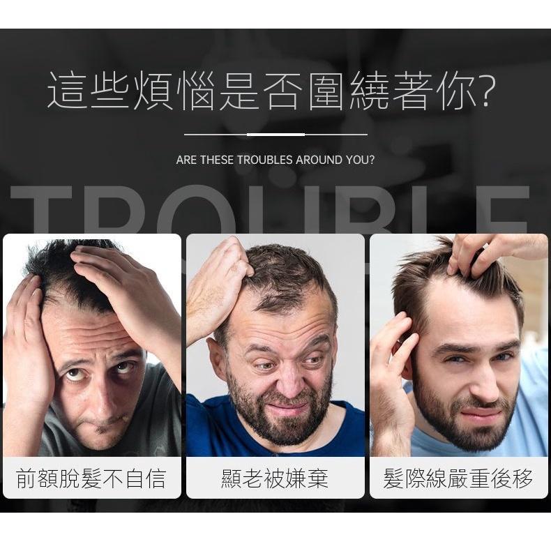 質感如天生 □ 川崎家假髮 ■男生前額髮際線真髮瀏海發片透氣補髮片 毛坯/精修 可分線可裁剪-細節圖7