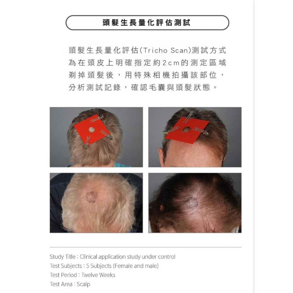 Dr.FORHAIR 頭皮護理豐盈健髮洗髮乳 10ml 5包 (玄彬代言) 試用包-細節圖4