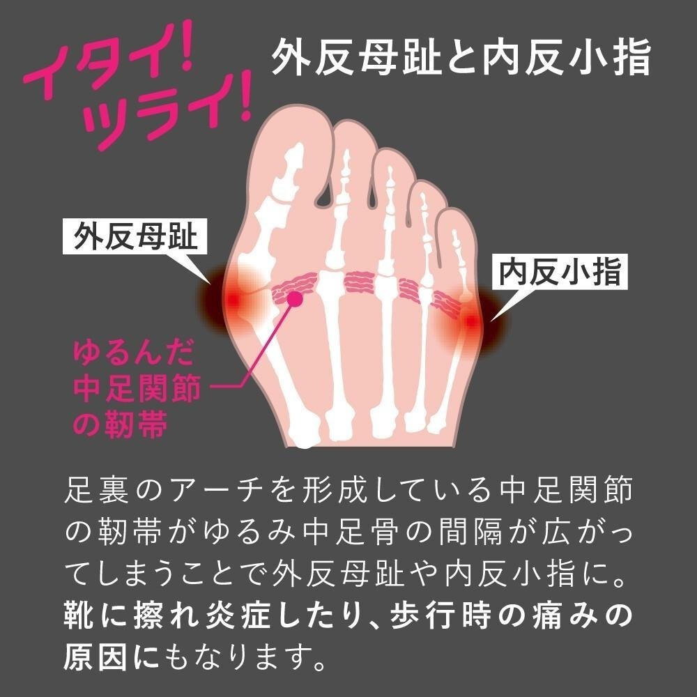 ✨拇指外翻矯正套✨現貨 日本製 日本Alphax 拇指外翻襪 腳踝護具 足弓支撐 分趾襪 拇指外翻 矯正襪 機能襪-細節圖5