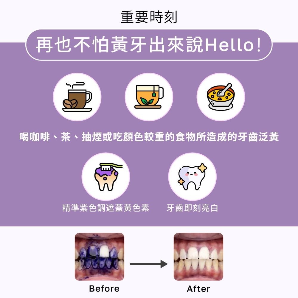 【免運】ELLO 研舒肌🔥益生菌牙齒即刻亮白矯正膏📢譽的生食舖【保證正品】【📌25/05/13】-細節圖8