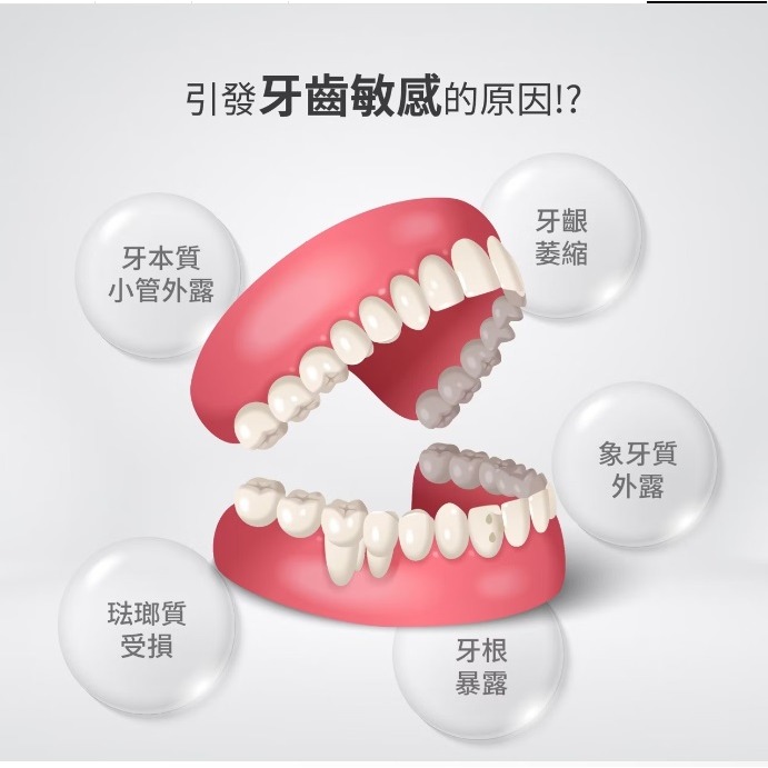 悠效 牙本肽濃縮護齦精華露 （15ml/支X4支入/盒 ) (牙齦護理/保養/強化)-細節圖5