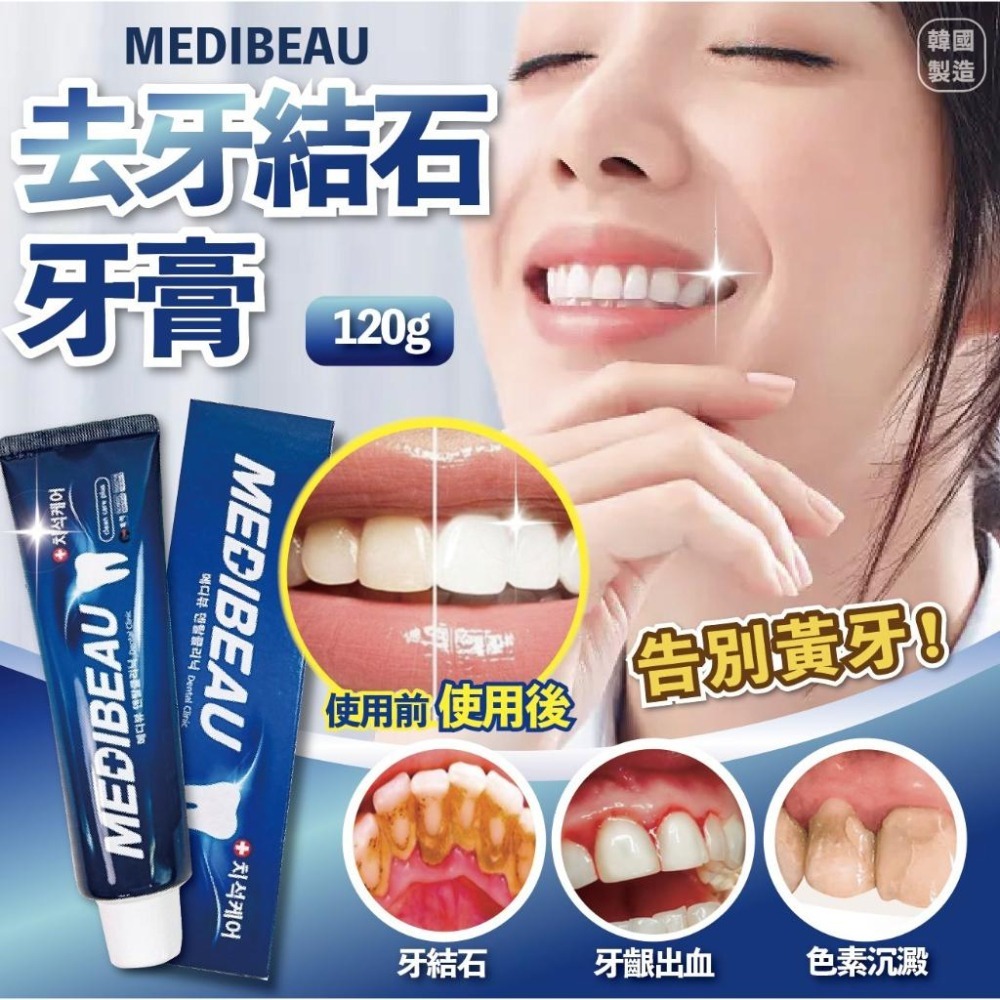 韓國製造 MEDIBEAU 全效固齒去牙結石牙膏 120g【美日多多】-細節圖2