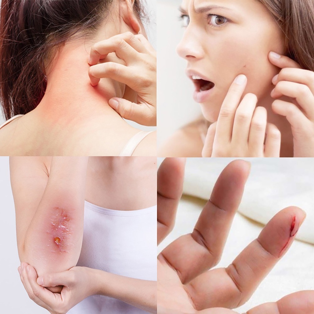 台灣正宗火龍膏 （萬用膏）100g 就是好用!-細節圖3