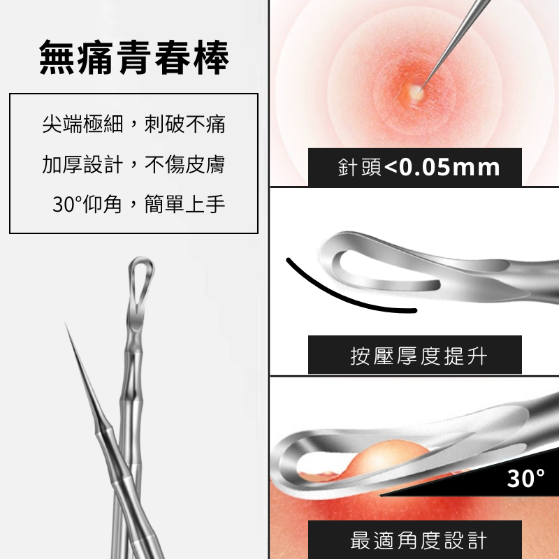 【PinGeLife.】德國工藝專業粉刺組 專業粉刺夾 加厚青春棒 粉刺針 痘痘棒 粉刺棒 擠痘棒 黑頭夾 痘痘針-細節圖4