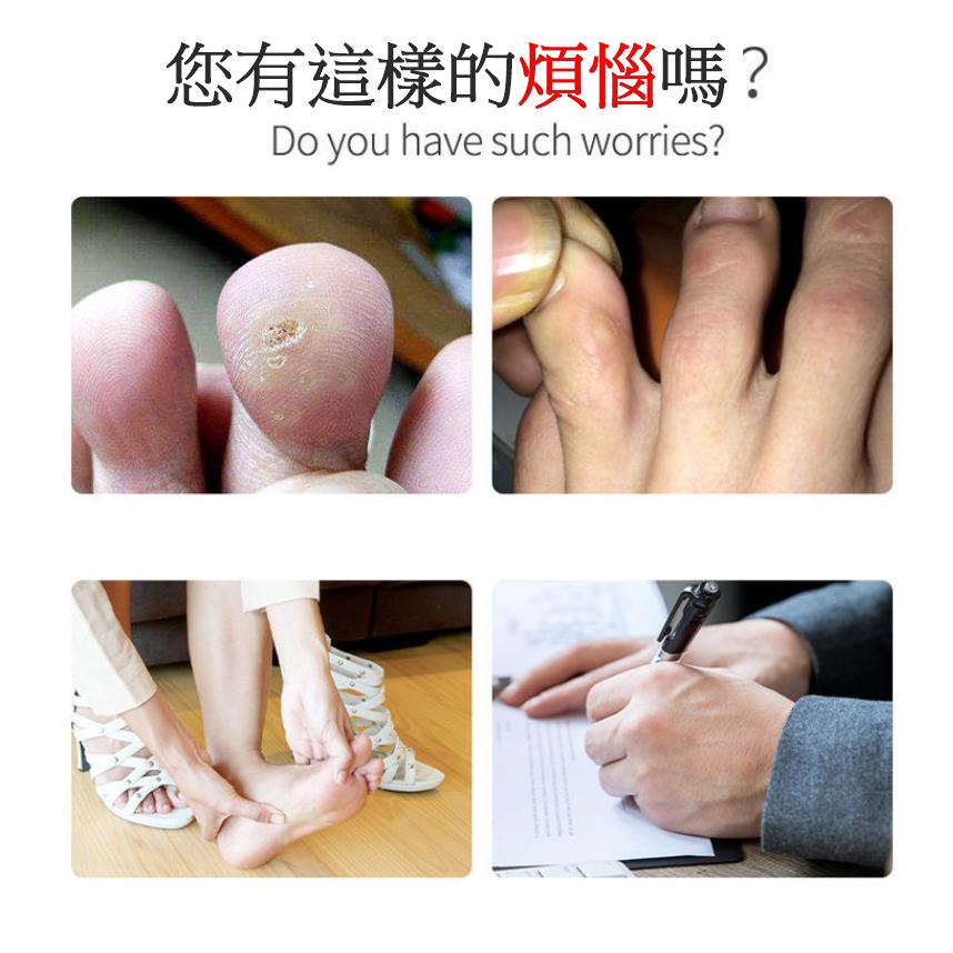 D48 纖維凝膠腳趾套 腳趾保護套 手指保護套 雞眼腳趾套 腳趾套 動防磨指套 手指套 雞眼 防磨套 凝膠防磨套-細節圖3