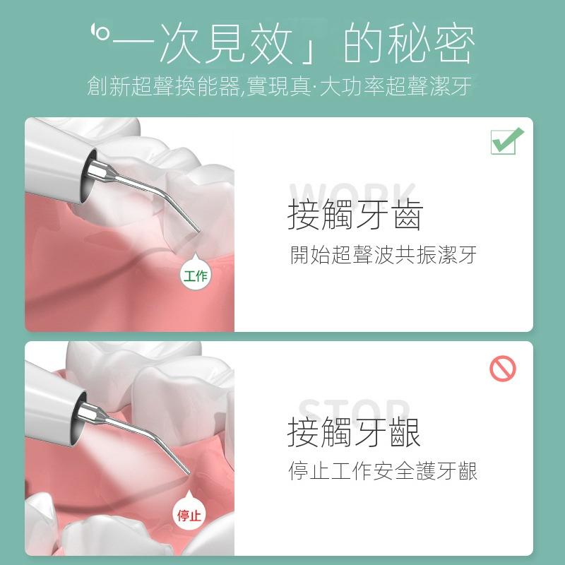 牙結石去除器  牙齒美白 可視超聲波潔牙器 沖牙機 沖牙器 牙垢 牙污漬 煙漬 茶漬去除 口腔清潔護理 牙結石 洗牙機-細節圖4
