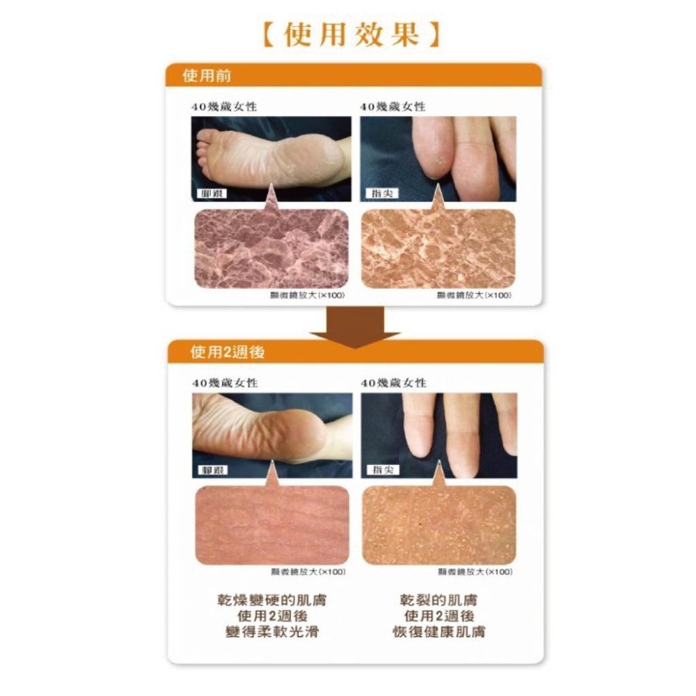 【悠斯晶yuskin】全系列｜日本製｜悠斯晶 A｜乳霜｜護手霜｜按壓瓶｜藥局直營-細節圖3