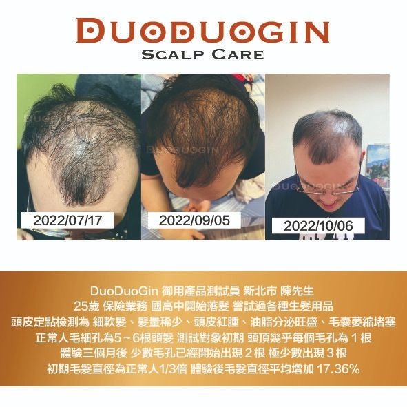 【ASIAGOGO亞洲購】DuoDuoGin – 頭皮保養液X1罐-細節圖4