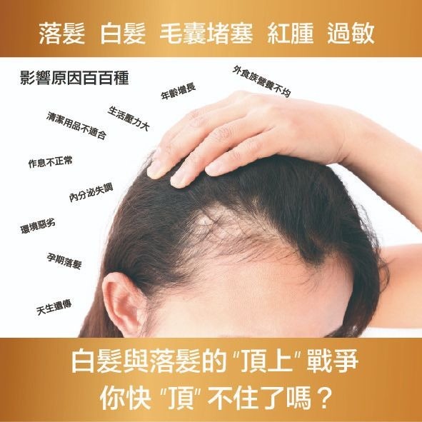【ASIAGOGO亞洲購】DuoDuoGin – 頭皮保養液X1罐-細節圖7