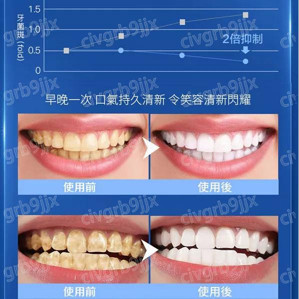 輝煌鑽石鯊魚益生菌美白酵素牙膏 SP-Y6 保護牙釉質 改善蛀牙 長年茶漬 咖啡漬 口臭 100g-細節圖7