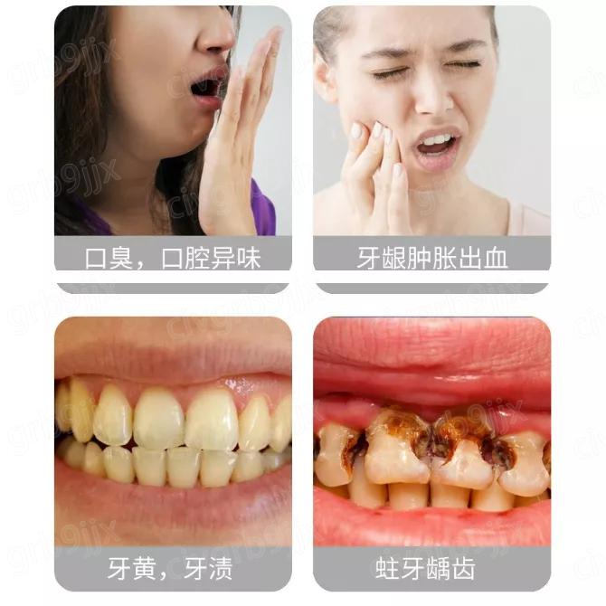 愛索美海洋之風牙膏 口腔護理 牙齒 去黃去漬 海洋薄荷香型 牙黃口臭清火 100g-細節圖2