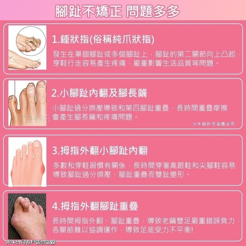 【小丸子】美腿足部矯正分趾套(一雙)-細節圖2