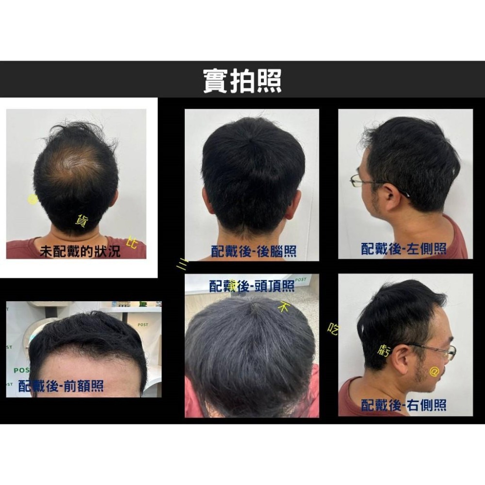 @貨比三家不吃虧@男士頭頂髮片毛寸款 男短髮毛寸 接片髮 輕薄透氣 補髮塊 頭頂補髮片 頂芯補髮 假髮套 男士短髮-細節圖5