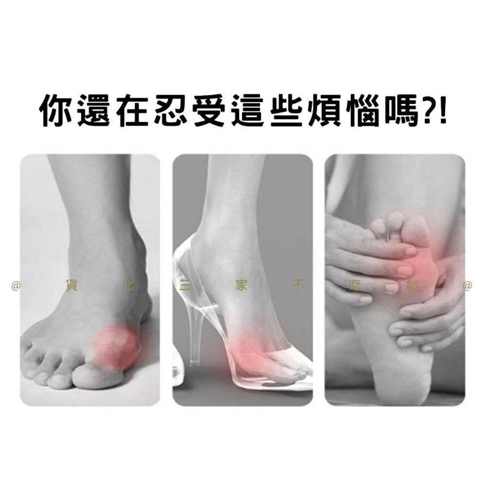 @貨比三家不吃虧@ 腳拇指套 拇指外翻 大拇指骨套矽膠保謢套 兩趾分離套 趾部護墊 男女可穿 彈力拇指外翻套 指套-細節圖2