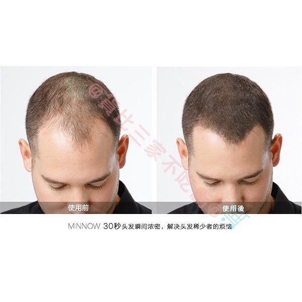 MINNOW 增髮纖維 速增髮 髮際線筆 頭髮粉 密髮纖維 魔髮粉 長黑髮 稀髮 纖維假髮 增髮粉 增髮量粉 遮蓋隱藏-細節圖6