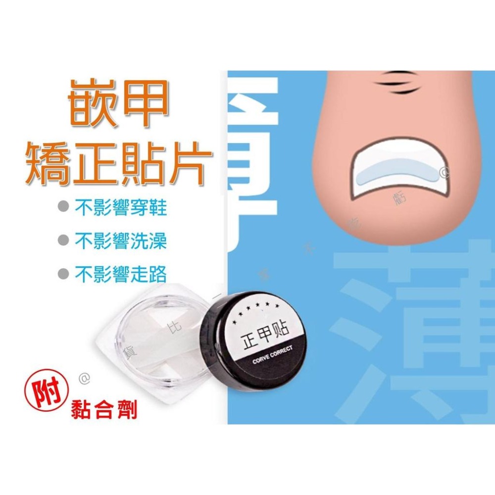 @貨比三家不吃虧@嵌甲矯正貼片 甲溝炎神器 嵌甲矯正器 凍甲貼片 指甲修護貼片 糾正指甲卷 無痕貼 正甲扣片 糾正肉包甲-細節圖9