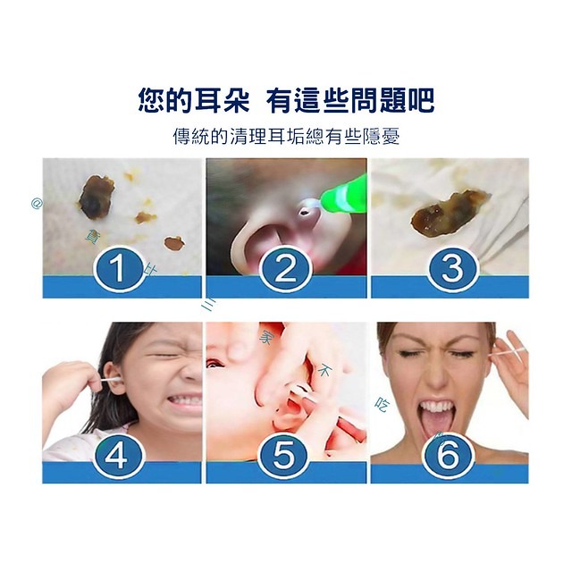 @貨比三家不吃虧@洗耳套組 洗耳器 耳屎 耳道沖洗器 采耳工具 洗耳神器 掏耳 耳扒 粘耳屎 耳結石 清潔耳垢 沖耳器-細節圖2